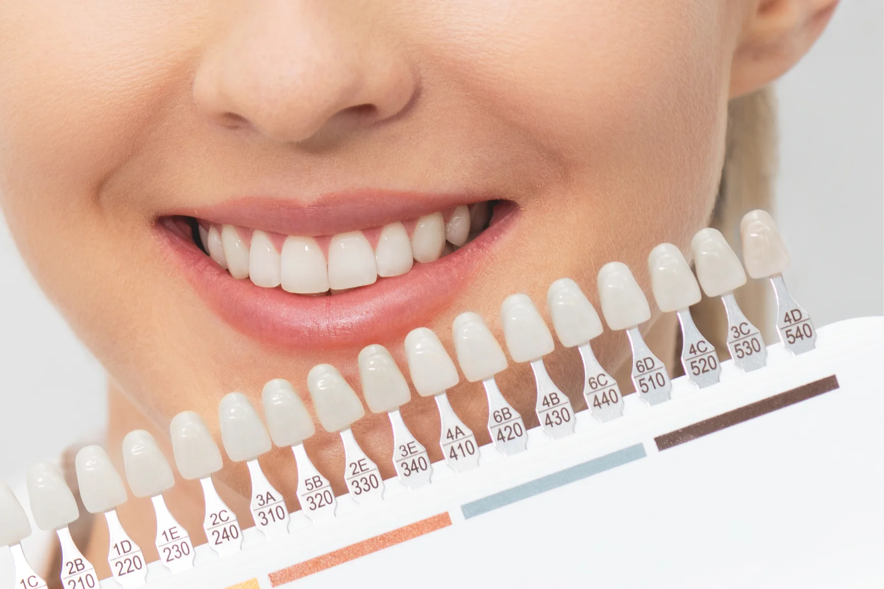 Ästhetik: Bleaching weiße Zähne